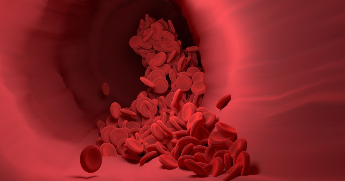 Kebiasaan Sehari-hari yang Membantu Mengurangi Risiko Trombozis